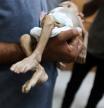 SENSITIVE MATERIAL. THIS IMAGE MAY OFFEND OR DISTURB A man carries the body of Palestinian baby Zainab Abu Haleeb, who died due to malnutrition, according to health officials, at Nasser Hospital in Khan Younis, southern Gaza Strip, July 26, 2025. REUTERS/Ramadan Abed TPX IMAGES OF THE DAY
