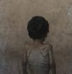 Yazan Abu Ful, a 2-year-old malnourished child, poses for a photo at his family home in the Shati refugee camp, in Gaza City on Wednesday, July 23, 2025. (AP Photo/Jehad Alshrafi)