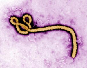 La nueva epidemia de ébola de RD Congo será una de las peores de la historia